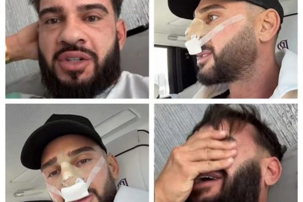Dorian Popa: De la Vis Estetic la Provocare Medicală – O Analiză Detaliată a Intervenției Chirurgicale