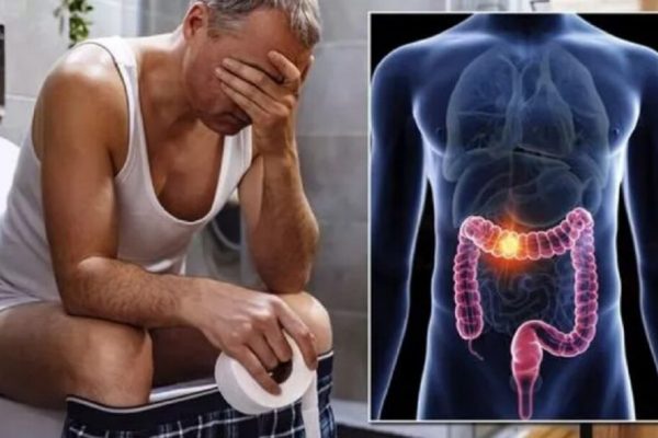 Impactul consumului de alcool asupra riscului de cancer de colon: o analiză detaliată