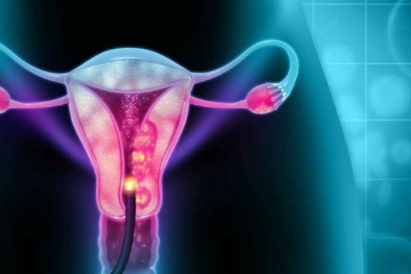 Mirosul neplăcut din zona intimă: Semne de alarmă pentru sănătatea femeilor și impactul cancerului de col uterin