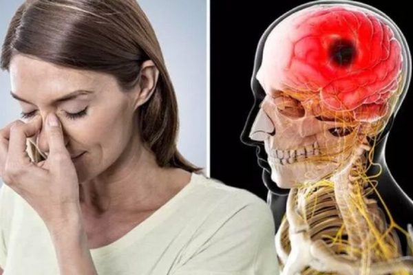 Durerile de cap: semnalul alarmant al unui accident vascular cerebral