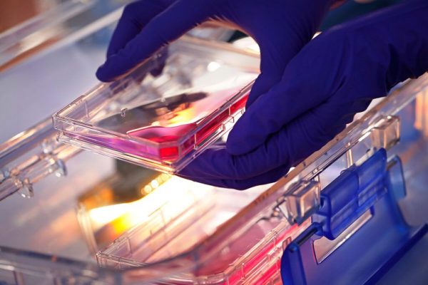 Progrese Semnificative în Tratamentul Cancerului de Prostată: O Nouă Speranță pentru Pacienții din România