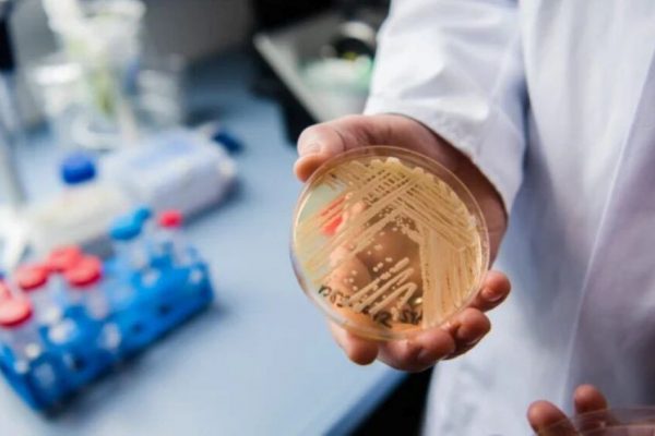 Dieta în Suprapopularea cu Fungi a Intestinului Subțire: O Perspectivă Detaliată de la Dr. Oana Bucur