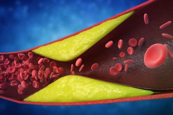 Descoperirea sucului de rodie: un elixir pentru sănătatea cardiovasculară