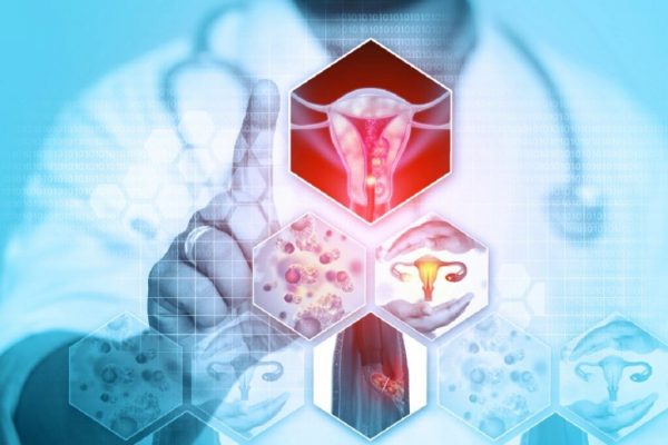 Cancerul de col uterin: O amenințare tăcută care necesită atenție urgentă