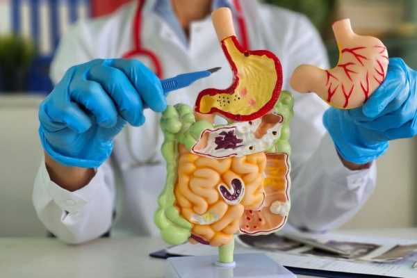 Chirurgia Bariatrică: Când și Cine Este Candidatul Ideal pentru Operația de Micșorare a Stomacului
