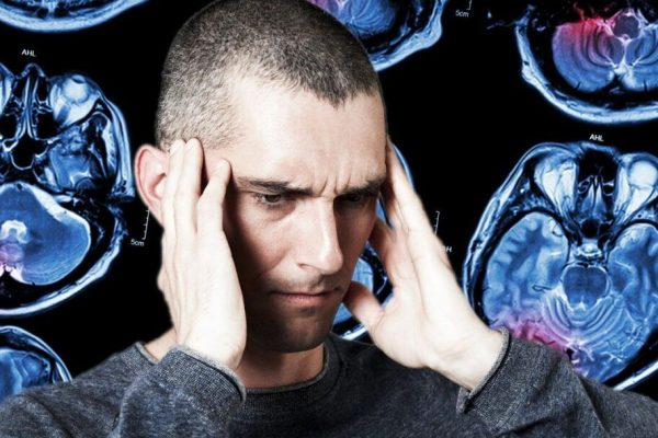 Simptomele Rare ale Accidentului Vascular Cerebral: Ce Trebuie să Știm pentru a Ne Proteja Sănătatea