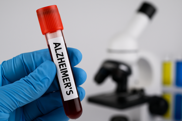 Impactul Poluării Aerului asupra Bolii Alzheimer: O Amenințare Nebănuită pentru Sănătatea Mentală Globală