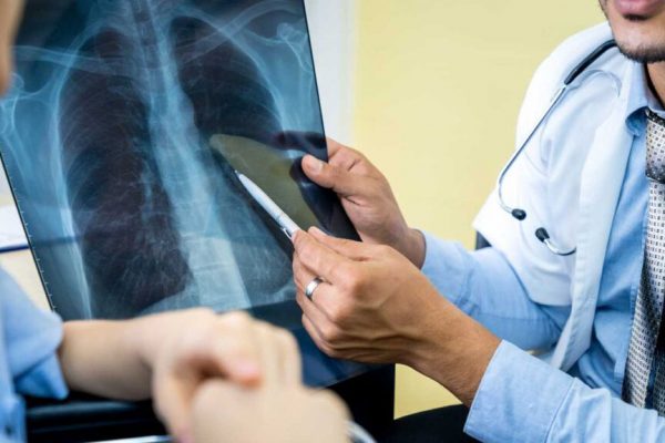 Long Covid: O Afecțiune Persistenta Cu Peste 200 de Simptome Care Afectează Viețile a Milioane de Oameni