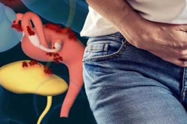 Endometrioza: Dreptul la o zi liberă plătită pentru femeile afectate – O victorie în lupta pentru sănătate