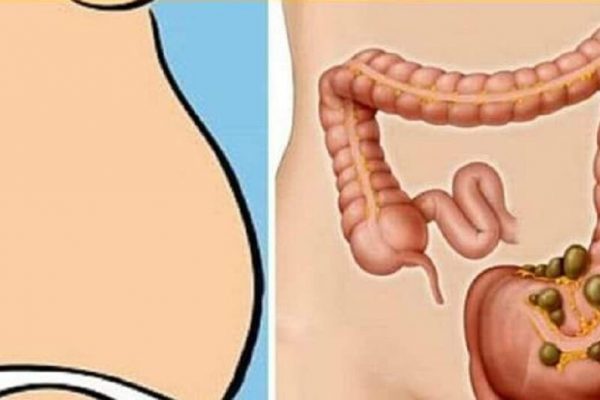 Deficiențele de vitamine ca factor principal în constipație: O analiză detaliată