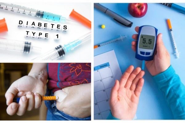 Revoluția în tratamentul diabetului de tip 1: Celulele stem ca soluție pentru eliminarea insulinei