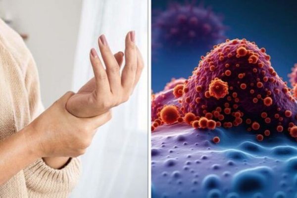 Semne Timpurii de Cancer: Ce Trebuie Să Știi pentru a Te Proteja
