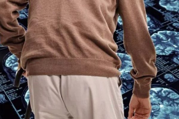 Semnele subtile ale demenței: Cum îmbrăcămintea poate indica o deteriorare cognitivă