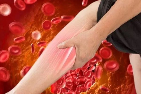 Ghidul complet pentru scăderea colesterolului: Ce trebuie să știe fiecare pacient