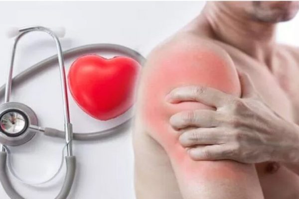 Colesterolul și Inflamația: O Relație Complexă Ce Poate Modela Sănătatea Cardiovasculară