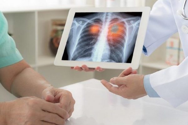 Cazuri alarmante: Creșterea bărbaților care ajung la urgență cu obiecte blocate în rect