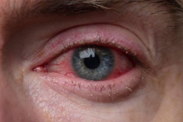 Semnele din ochi pe care nu trebuie să le ignori: când este esențial să mergi la medic