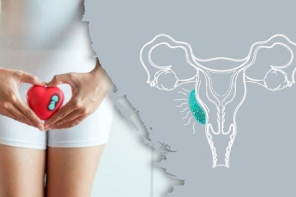 Cancerul Vulvar: O Problemă Ignorată Care Necesită Atenție Urgentă