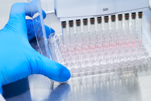 Analiza HbA1c: Indicatorul esențial pentru controlul diabetului pe termen lung