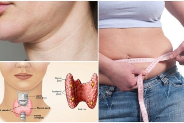 Strategii de Slăbire pentru Persoanele cu Hipotiroidism: Importanța Proteinei în Dietă