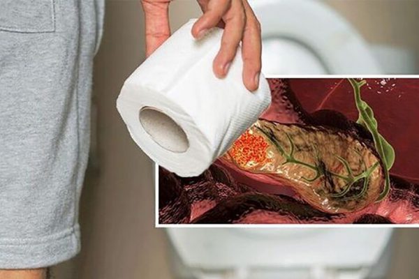 Ce ne spune scaunul despre sănătatea noastră? Analiza detaliată a semnelor de avertizare în digestie