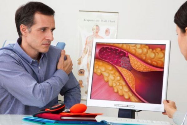 Noile Ghiduri Medicale pentru Gestionarea Colesterolului: Implicații pentru Sănătatea Cardiovasculară