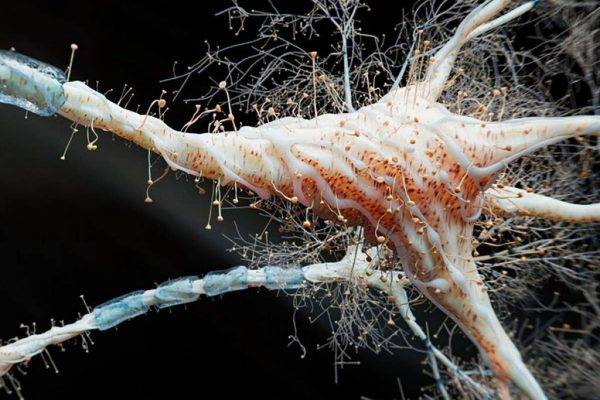 Inflamația intestinală: O nouă perspectivă în înțelegerea sclerozei multiple