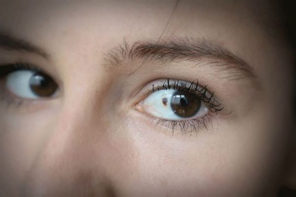 Semnele de alarmă ale cancerului ocular: Ce trebuie să știm despre sănătatea ochilor noștri