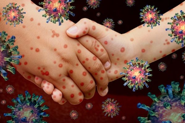 Impactul bolilor cu transmitere sexuală tăcute: Pericolele invizibile pentru sănătatea ta