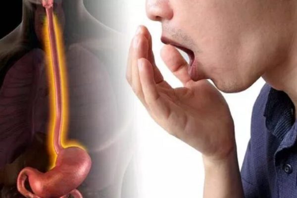 Sindromul de colon iritabil: un simptom jenant și neglijat – respirația urât mirositoare