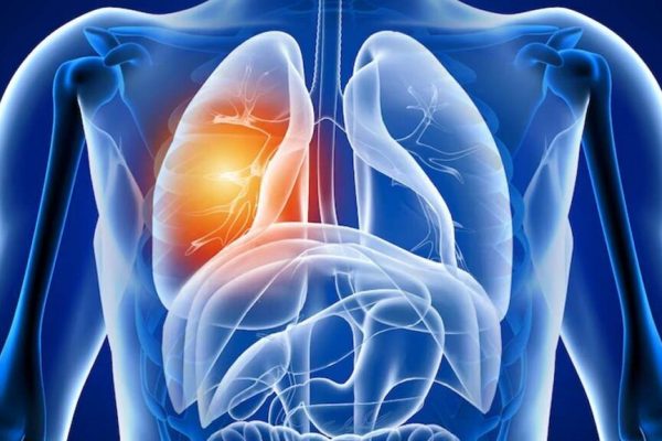 Consecințele Covid-19 asupra sănătății pulmonare: O analiză profundă a riscurilor post-pandemie