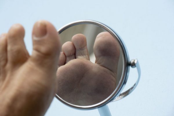Diabetul de tip 2: Semnele de avertizare pe picioare care nu trebuie ignorate
