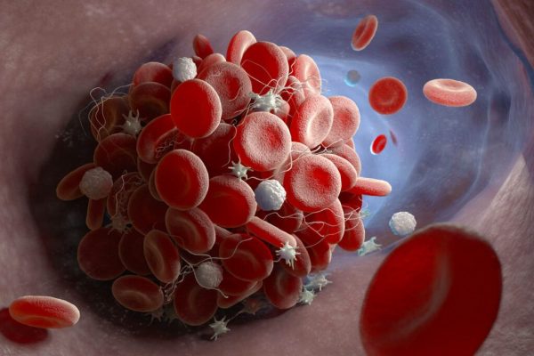 Anticoagulante naturale: Alimentele care subțiază sângele și protejează sănătatea cardiovasculară