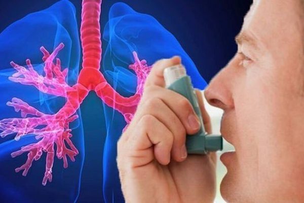 Astmul în România: Provocări, Tratament și Impactul Asupra Sănătății Publice