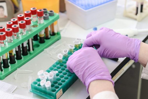 Revoluția Screeningului pentru Cancerul Colorectal: Analiza de Sânge Aprobata și Impactul Asupra Sănătății Publice din România