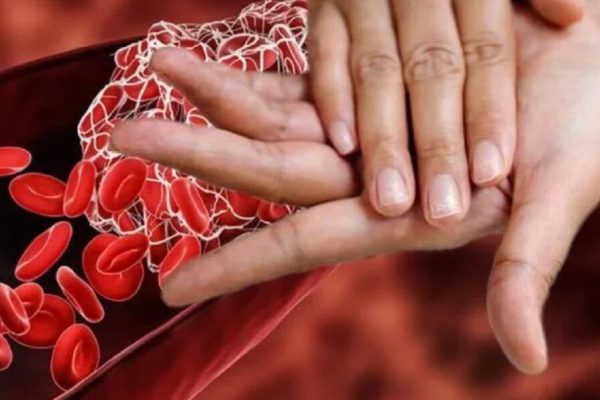 Semnele Ascunse ale Colesterolului Rău: Ce Ne Pot Spune Unghiile Despre Sănătatea Cardiovasculară