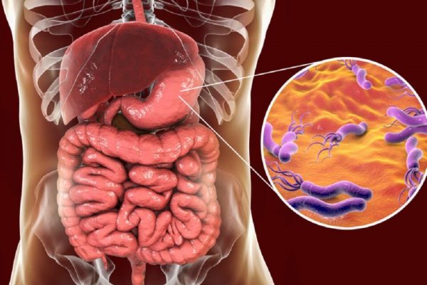 Revoluția Probioticelor: O Nouă Speranță în Combaterea Cancerului Gastric