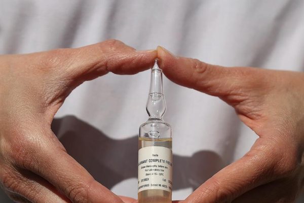 Revoluția în Tratamentul Cancerului de Colon: Imunoterapia Preoperatorie Schimbă Destinul Pacienților