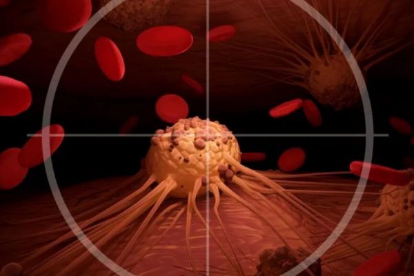 Gleevec: Revoluția în Tratamentul Leucemiei Mieloide Cronice și Impactul Său Asupra Oncologiei Moderne