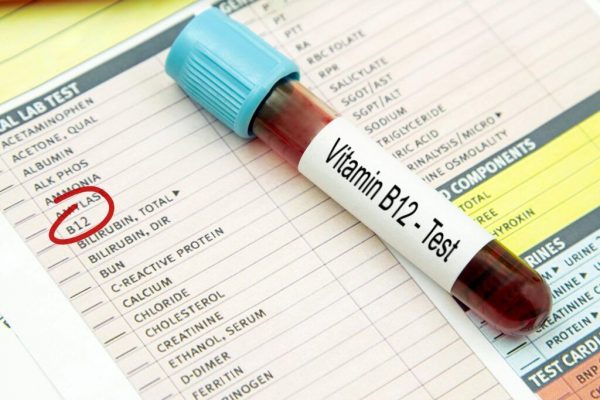 Vitamina B12 și cancerul: O analiză detaliată a legăturilor complexe și a miturilor periculoase