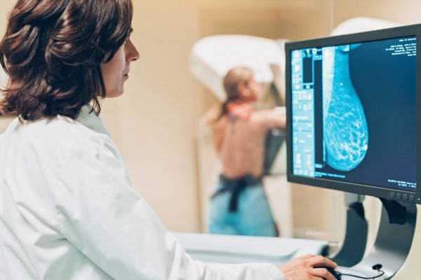 Decizii Critice în Screeningul Cancerului de Sân: Vârsta Optimă pentru Mamografie și Repercutiile Sale