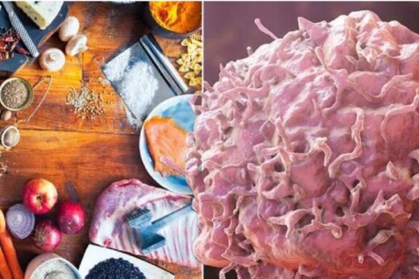 Cele 5 alimente toxice pe care ar trebui să le eviți pentru o sănătate optimă: Analiza unui onco-nutriționist