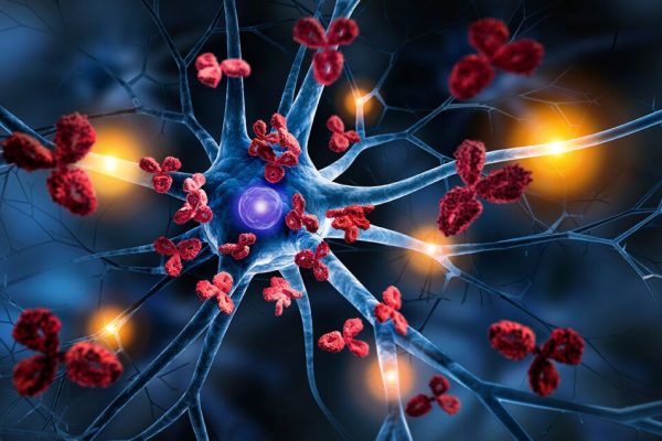 Terapia CAR T: O Revoluție în Tratamentul Bolilor Autoimune
