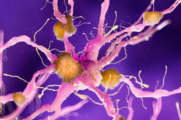 Semnele timpurii ale Alzheimerului: Descoperiri revoluționare la vârsta de 45 de ani