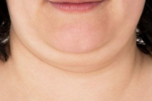 Vitamina E: Soluția Naturală pentru Reducerea Bărbiei Duble și Gușei