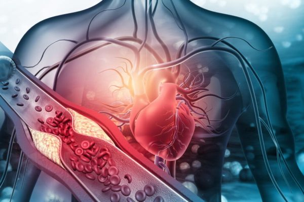 7 Alimente Surprinzătoare care Pot Curăța Arterele: O Analiză Detaliată