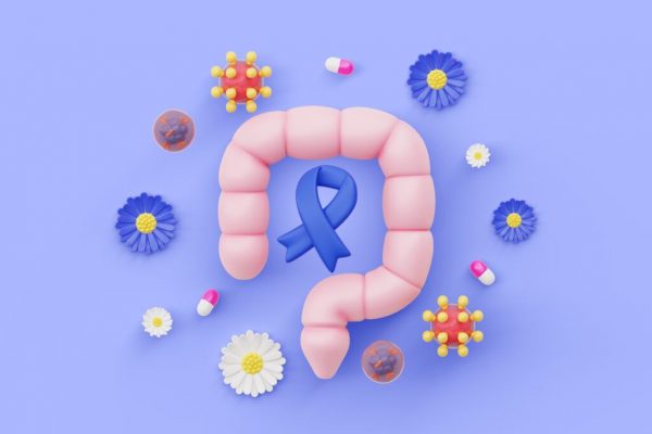 Reducerea riscului de cancer de colon prin dietă: un ghid detaliat despre prevenție și sănătate intestinală