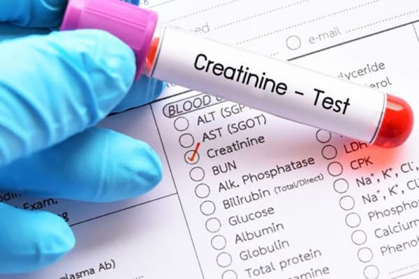Înțelegerea Creatininei: Indicatorul Esențial al Sănătății Rinichilor