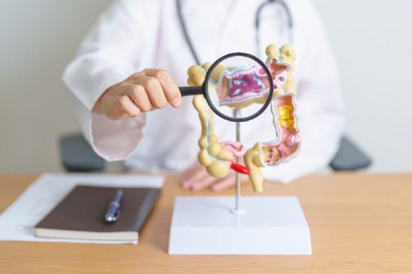 Semnele Cancerului de Colon: Ce Trebuie Să Știm pentru a Ne Proteja Sănătatea
