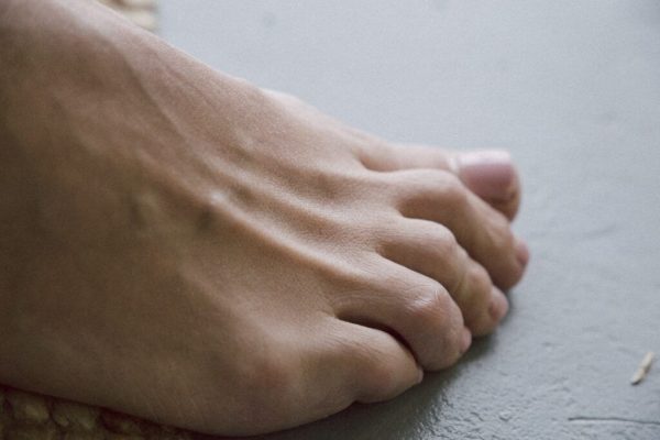 Părul de pe degetele de la picioare: indicații medicale și asocieri cu afecțiuni hormonale
